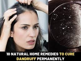You can wash your scalp with shampoo after about 5 minutes to see a clean, dandruff free scalp. How To Get Rid Of Dandruff Fast Permanetaly At Home Best Beauty Lifestyle Blog