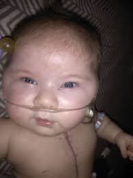 Discussion about peaches and medical facilities