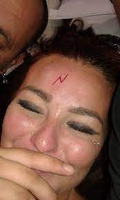 Drunk People Are Now Getting Harry Potter Lightning Bolt Tattoos On Their Foreheads