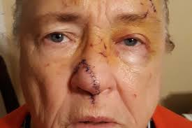 Fundraiser by Ronnie Robin Duncan : Elderly Victim of Violent Crime