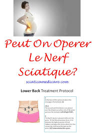 Pin On Sciatique