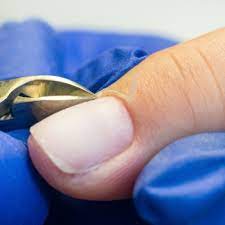 We did not find results for: Is The Skin Around Your Nails Hard And Calloused Makeover Momma