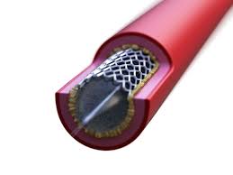 The catheter is placed percutaneously through an existing nephrostomy tract. El Hospital General Busca El Record De Mediciones De Colesterol En Un Dia Radio Alicante Actualidad Cadena Ser