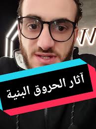 Replying to @zyno472 #yuli_care #yuli_ratino #skincare #د_عمرو_علي_ريشة  آثار الحروق البنية