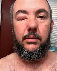 Both the brakefire boys had to go to the hospital yesterday. I had  irregular heartbeats, palpitations and my heart was stopping for 10-15  seconds at a time. EKG at urgent care was