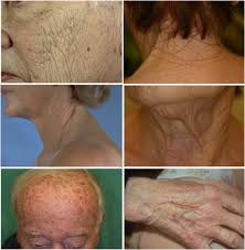 Learn what you can do to preserve your vision. Aesthetic Aspects Of Skin Aging Prevention And Local Treatment Sciencedirect