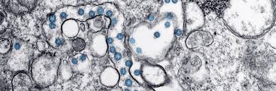 Coronavirus counter with new cases, deaths, and number of tests per 1 million population. Covid 19 Aip Publishing Llc