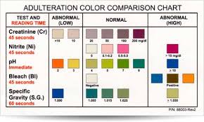 51 all inclusive abnormal urine color chart