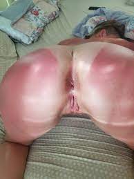 Sunburned porn ❤️ Best adult photos at hentainudes.com