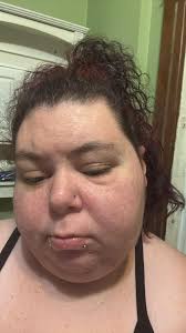 Face puffed up again. Something got screwed up with getting my antibiotic  so have to call my regular dentist tomorrow. Hopefully they can get me an  antibiotic ASAP and also get me