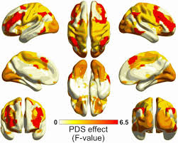 Development of the Functional Connectome Topology in Adolescence: Evidence  from Topological Data Analysis