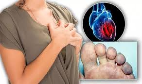 Some of these are a sign of something urgent, and others are not. Heart Attack Symptoms Signs Of Heart Disease Include Having Blue Skin Express Co Uk