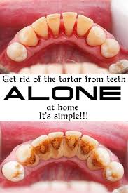 8 Mistakes You Make About Thin Hair Tooth Decay Oral Health Care Oral Care