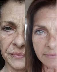 Character skin recommendation for rectifier