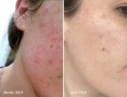 Sans huiles essentielles et saponifié à froid. Mon Avis Sur Les Produits De La Gamme Soins Visage Pinup Secret