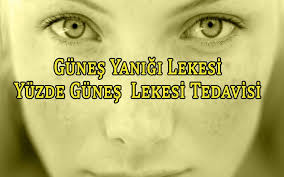 Gunes Yanigi Lekesi Kitap Cil Saglik
