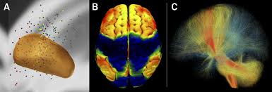 Anatomy mapper has been online since 2009, and has lead to numerous publications and international collaborations. Dbs Network Mapping Lead Dbs