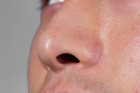 Big nose short hairstyles with regard to short hairstyles for large noses view photo 8 of 20. Nostril Hair Grows Out Can It Be Removed Or Cut Off Nose Hair Is Too Long What Is Going On Inews