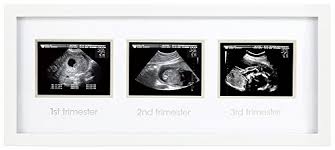 This is when the baby is putting a lot of pressure on your organs, causing issues like shortness of breath. What To Put In A First Trimester Care Package Mml