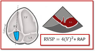 Technical Measure Cardioserv Echocardiogram Cardiac Sonography Technical