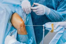 23 questions, 186 members, 38 news articles. Locked Knee Treatment Knee Pain Explained
