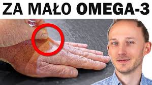 F. Chopin etiuda e moll -Daniel Goryl