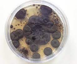 Fonsecaea pedrosoi is a fungal species in the family herpotrichiellaceae, and the major causative agent of chromoblastomycosis. Scielo Brasil Fonsecaea Pedrosoi As A Rare Cause Of Acute Conjunctival Ulceration Fonsecaea Pedrosoi As A Rare Cause Of Acute Conjunctival Ulceration