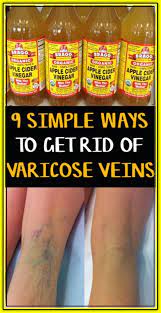 Pin On Health And Beauty Tips