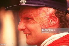 He went on to finish third after a puncture cost him the lead. Niki Lauda Stock Fotos Und Bilder Getty Images