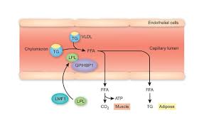 Image result for Hypertriglyceridemia