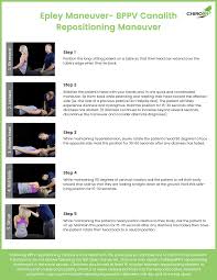 Image result for Canalith Repositioning Procedure