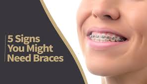 Invisible braces is the common vernacular for what's really called clear aligners.. Do You Need Braces 5 Signs You Can Look For