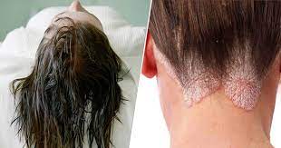 Want luxurious waves without the work? Sleeping With Wet Hair Is Bad For You Here Are 6 Reasons To Always Dry Them Before Sleeping Good Times