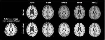 Style Transfer Using Generative Adversarial Networks For Multi Site Mri Harmonization Biorxiv