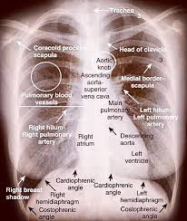 Anatomia De Los Huesos Radiology Student Radiology Radiology Imaging
