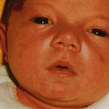 Police face legal action over retention of murder victims' body parts