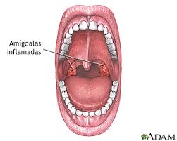 Amigdalectomia Serie Indicaciones Medlineplus Enciclopedia Medica