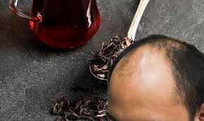 Hair loss at an earlier age is treated differently. Hair Loss Treatment Chinese Black Tea Shown To Reverse Alopecia Samachar Central