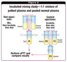 Image result for Modified Apt Test