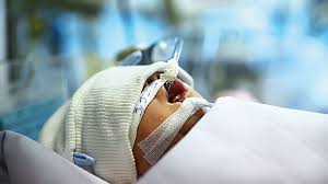 Vì vậy, hãy cùng tham khảo một số kinh nghiệm khám tại bệnh viện trong bài viết sau. Vá»¥ Tai Náº¡n Xe Trá»™n Betong Be Uá»'ng Sá»¯a Qua á»'ng Thong Dáº¡ Day Tuá»•i Tráº» Online