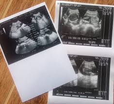 Hamil 4 bulan, perut kecil saat hamil perut kelihatan kecil saat hamil? Hamil 24 Minggu 28 Mei 2016 Haruskah Cemas Masalah Ukuran Perut Tiyaradam