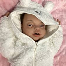 Babies Tagged "intubation"