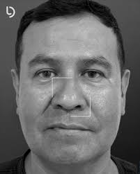 Dr David Lurduy Cirugía Plástica