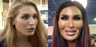 Laura Loomer before and after cosmetic fine tuning