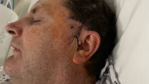 Fundraiser for Theresa Fulton by Tina Jones : Support Trey Fulton's Fight  Against Glioblastoma