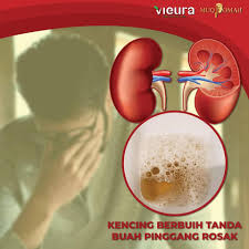 Check spelling or type a new query. Hq Alwiqoyah Brunei Posts Facebook