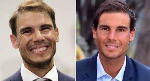 Nadal talks french open and the pressure to perform: Prominente Und Haartransplantationen Nadal Haarausfall Capilclinic