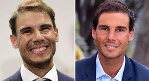 Rafael nadal reaches fourth round at french open by beating cameron norrie. Prominente Und Haartransplantationen Nadal Haarausfall Capilclinic