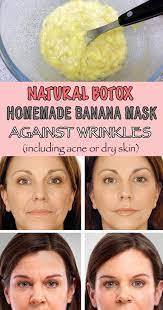 Natural Botox Homemade Banana Mask Against Wrinkles Including Acne Or Dry Skin Hexi Beauty Natural Botox Skin Care Wrinkles Anti Aging Homemade