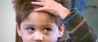 Lo Que Debes Saber En Caso De Golpes O Heridas En La Cabeza En La Infancia